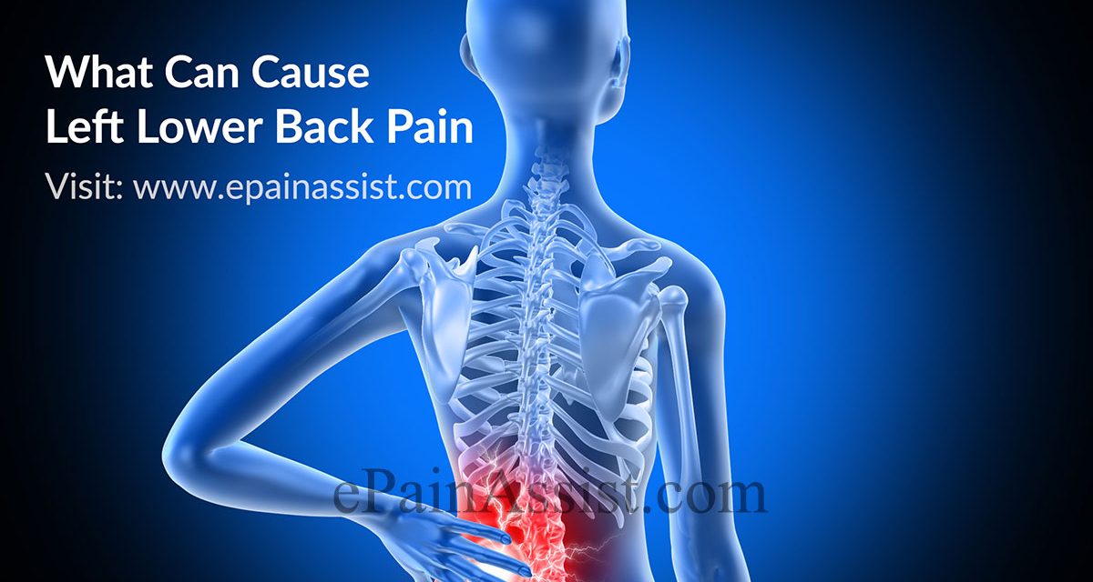 CAUSES OF LOW BACK PAIN zuniprobuys